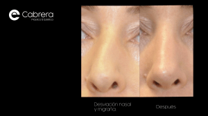 Captura-de-pantalla-2020-02-16-a-las-19.23.25-300x168 ¿Una rinoplastia puede curar o mejorar las migrañas?