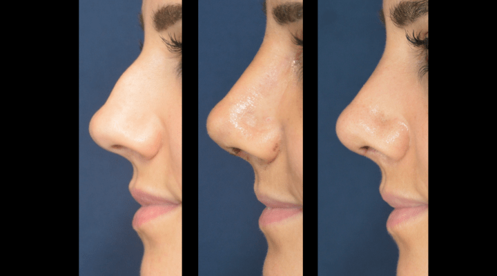 Captura-de-pantalla-2020-07-27-a-las-12.04.22-720x400 Noticias cirugía facial
